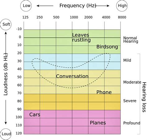 The audiogram: Detection of pure.